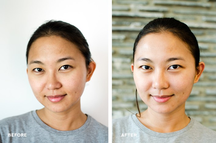 Biologique Recherche Facial Treatment Before and After
