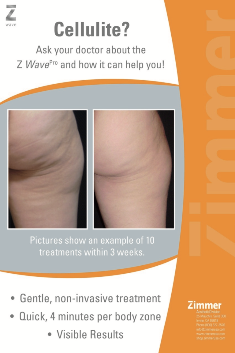 Zimmer Z Wave The Premier Cellulite Treatment SepiSpa